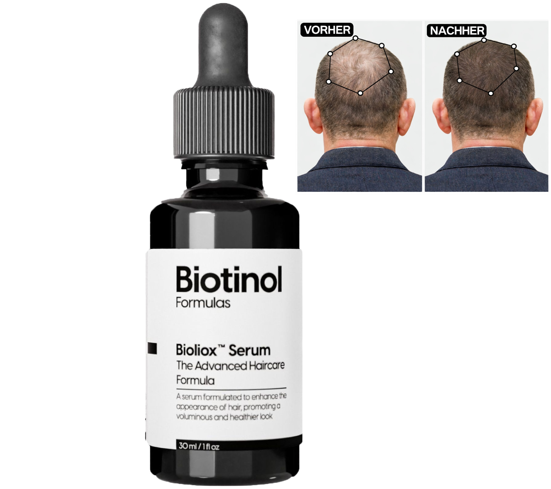 Siero per capelli al biotinolo per capelli più spessi e forti, contro la caduta dei capelli, clinicamente testato, alternativa al minoxidil, cruelty-free, 30 ml, nero/bianco