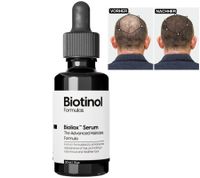 Biotinol Haarserum für dickeres kräftigeres Haar gegen Haarausfall Klinisch getestete Minoxidil-Alternative Haar-Pflege Tierversuchsfrei 30 ml Schwarz/Weiß