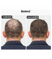 Biotinol Haarserum für dickeres kräftigeres Haar gegen Haarausfall Klinisch getestete Minoxidil-Alternative Haar-Pflege Tierversuchsfrei 30 ml Schwarz/Weiß