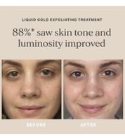 Soin exfoliant ALPHA-H Liquid Gold à l'acide glycolique - Soin cosmétique 50 ml