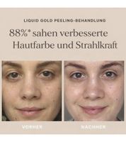 ALPHA-H Liquid Gold Peeling-Behandlung mit Glykolsäure Kosmetik Hautpflege strahlender Teint natürliche Hauterneuerung Hautstraffung 50ml