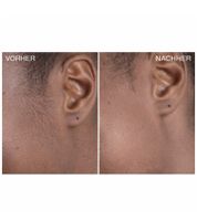 Confezione da 30 rasoi per dermaplaning Bondiblades da donna, ideali per la rimozione della peluria del viso, rosa e resistenti.